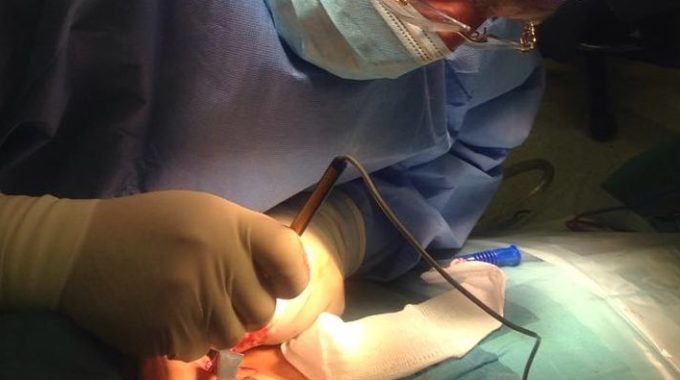 Daily Thyroid Durgery In Alzahra Cancer Center Dubai, UAE April 2018