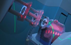 Radiation Therapy