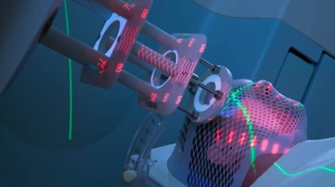 Radiation Therapy