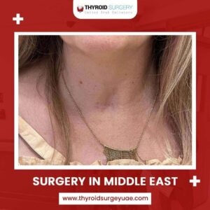 Surgery In Middle East