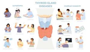 Thyroid Disorders And Symptoms